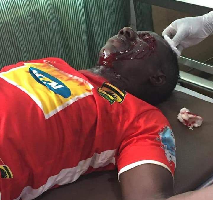 Special Competition: Fights and Gunshots at Berekum: Kotoko officials hospitalized